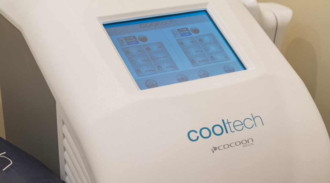 Beneficios del Cooltech para la reducción de grasa localizada: todo lo que necesitás saber