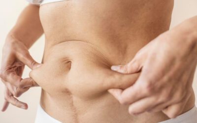 Cooltech: Reducción de Grasa sin Cirugía con Criolipólisis