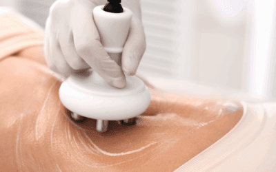 Estética corporal en Hudson: tecnología avanzada para moldear tu cuerpo sin cirugía