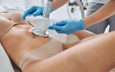 Estética corporal en Recoleta: tecnología y experiencia médica para cuidar tu cuerpo