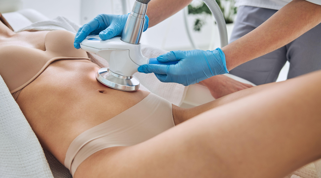 Estética corporal en Recoleta: tecnología y experiencia médica para cuidar tu cuerpo