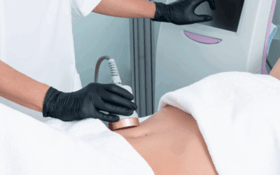 Tratamientos estéticos corporales: cuidarte también es una forma de quererte