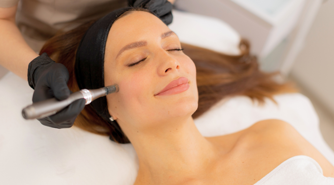 Rejuvenecimiento facial sin cirugía con bótox para arrugas y líneas de expresión